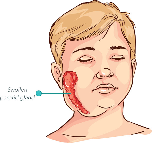Illustration of the parotid gland