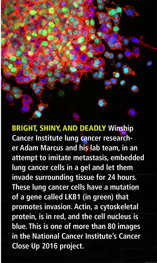 Cancer cells up close